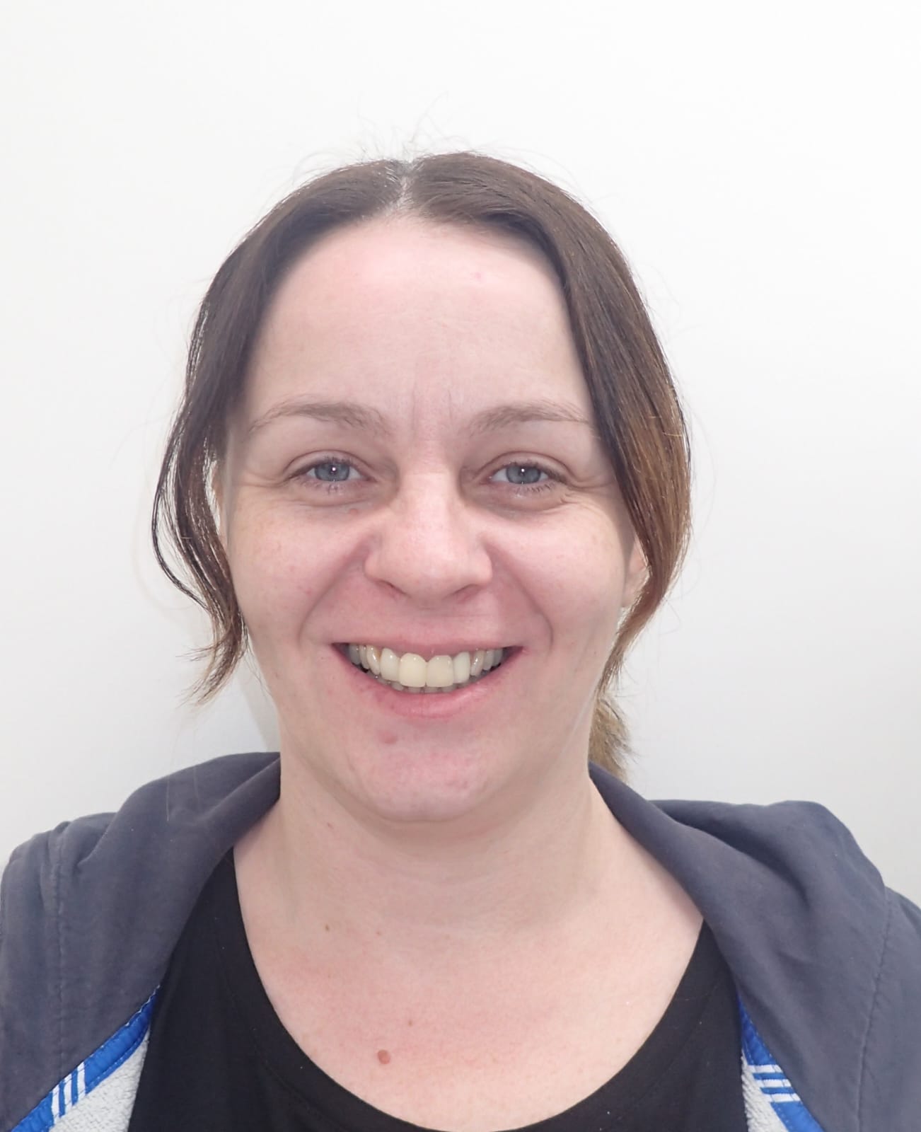 After - Smile Transformation 1