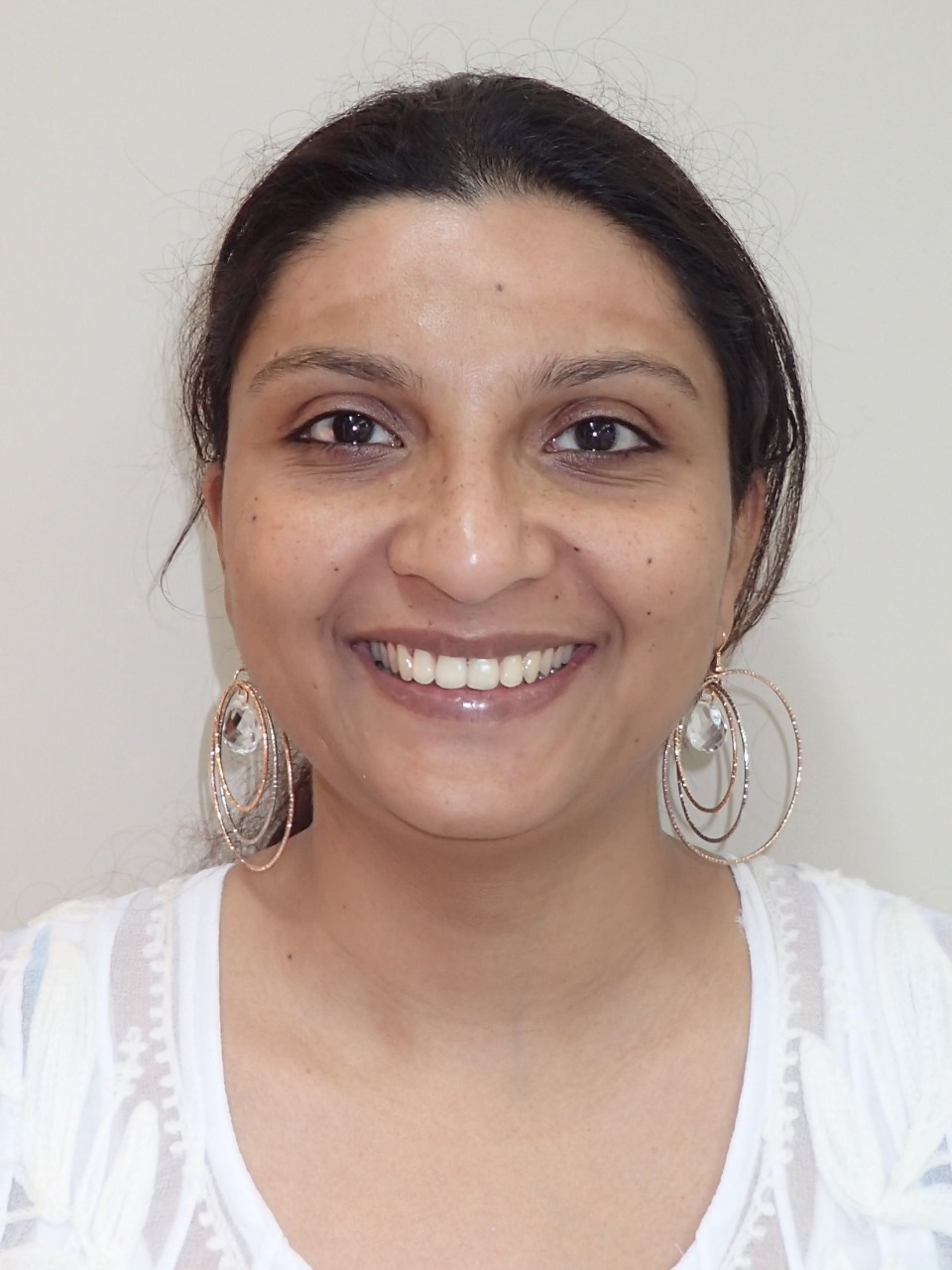 After - Smile Transformation 2